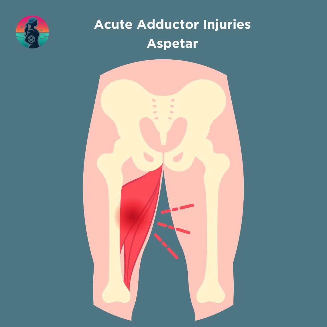 Muscle Injuries – Women's Football Hub